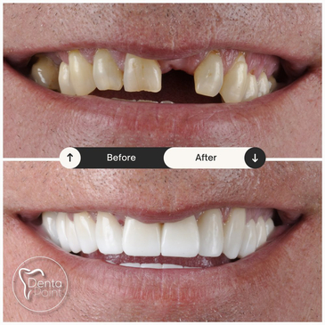 Slider image (2) DentaPoint International Dental Hospital